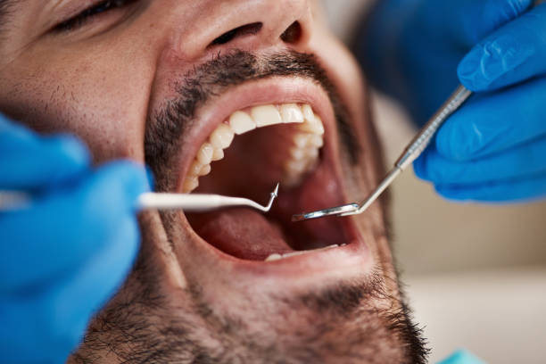 Best Emergency Treatment for Toothache in Fredericksburg, VA